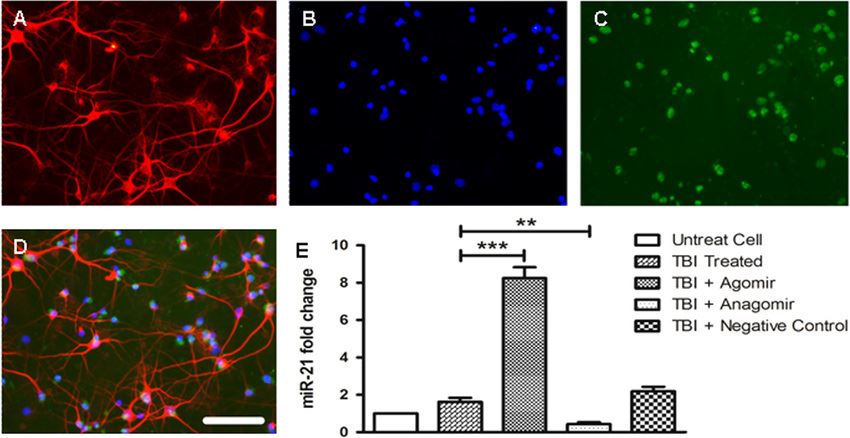The FAM-miR-21 agomir/antagomir transfected into cortical neurons and the expression level of miR-21.